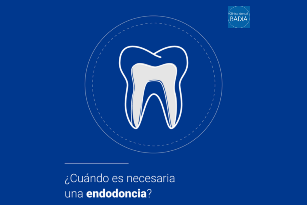 Es necesaria una endodoncia Clínica dental Badia